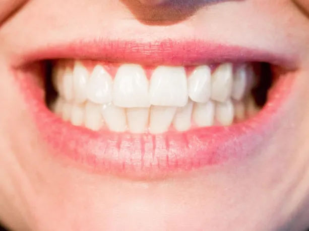 Understanding Teeth Grinding: Causes and Solutions